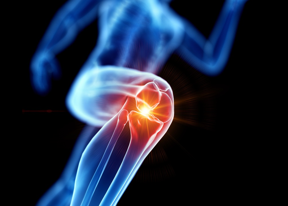 Knee Joint Pin